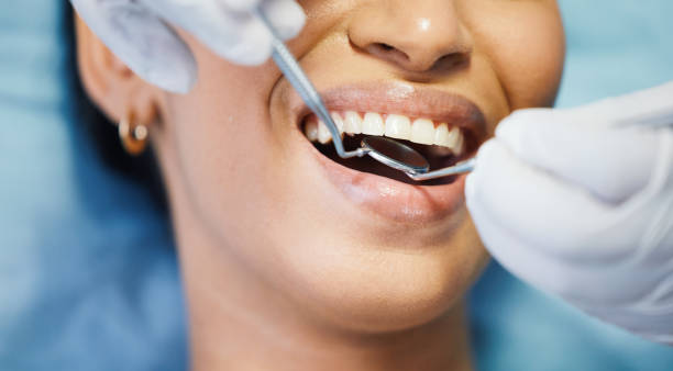Best Emergency Wisdom Teeth Removal in Mazon, IL